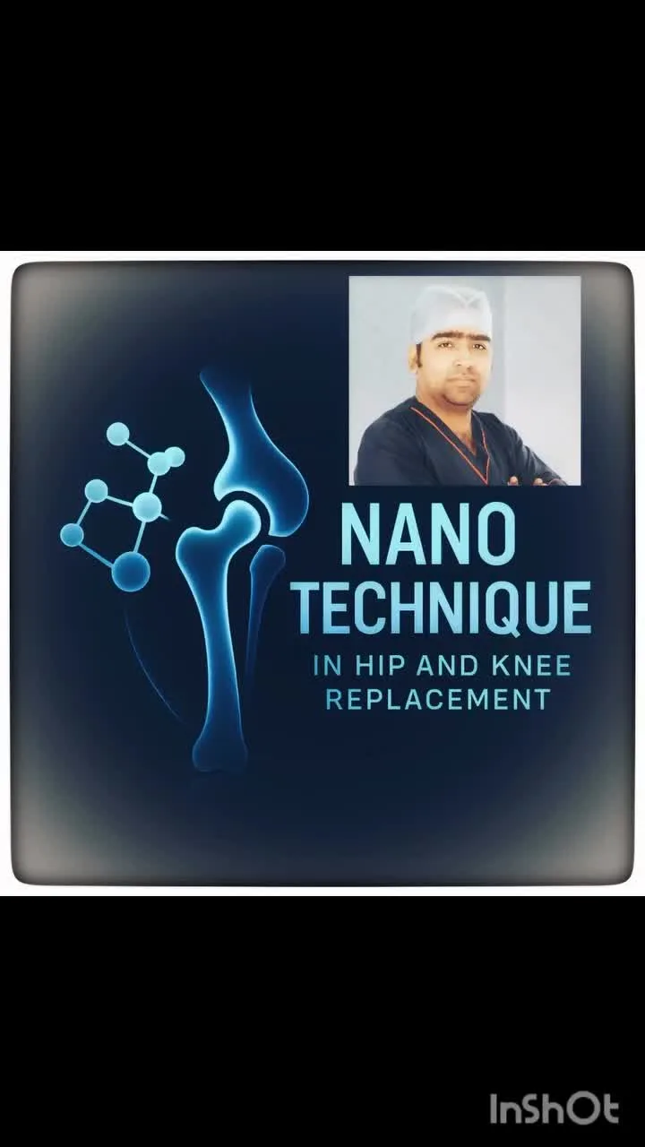Real patient walking on Day 1 after Nano Technique joint replacement with Dr. Amit Sinha — BIG Apollo Spectra Hospital